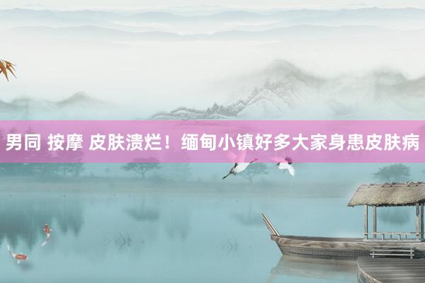 男同 按摩 皮肤溃烂！缅甸小镇好多大家身患皮肤病